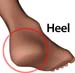 Man_heel