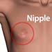 Man_nipple